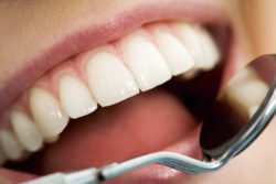 Preventive Dental Care in Annapolis Maryland