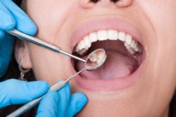 cosmetic dentist annapolis md
