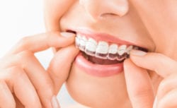 Invisalign Annapolis MD