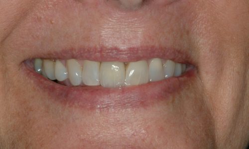 After dental services at Annapolis Center For Dental Health & Wellness