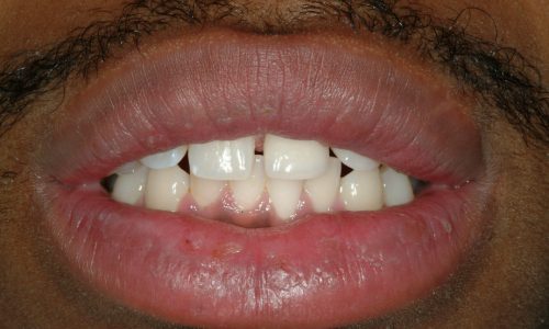 After dental services at Annapolis Center For Dental Health & Wellness