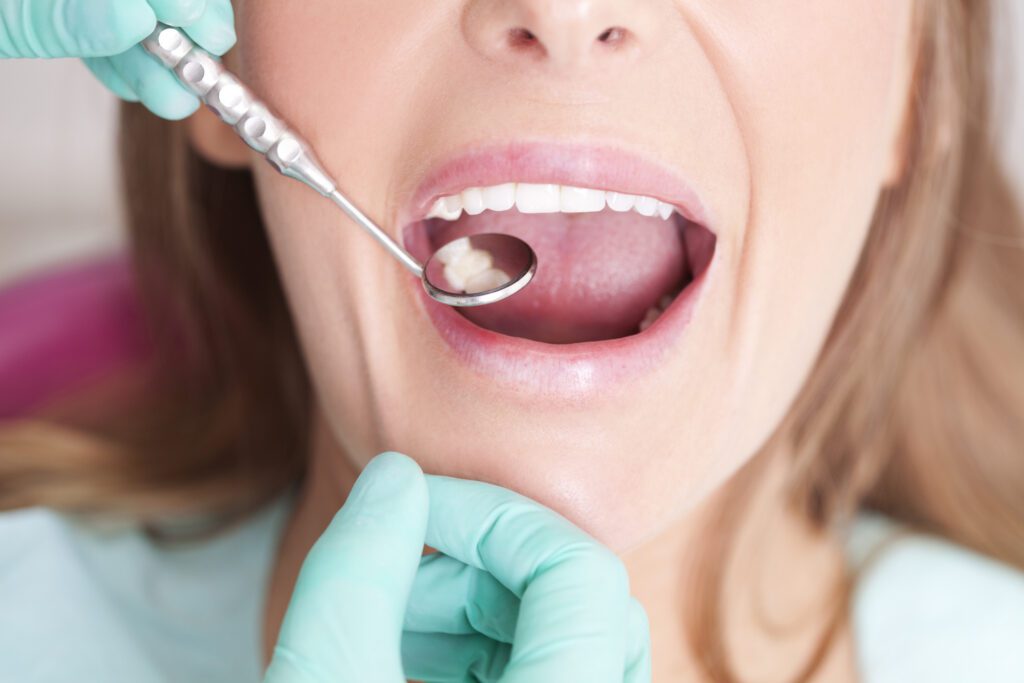 Oral Cancer Exam in Annapolis MD